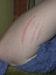 scratches on ruth